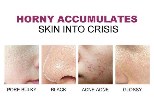 Deep Cleansing Exfoliating Peeling Gel