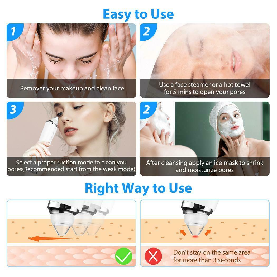 Blackhead Remover with a HD camera