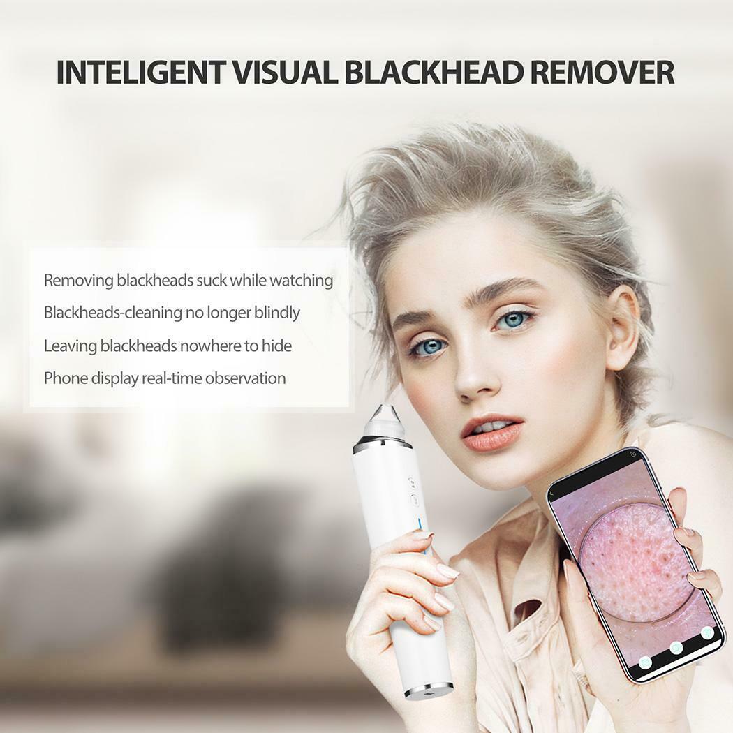 Blackhead Remover with a HD camera