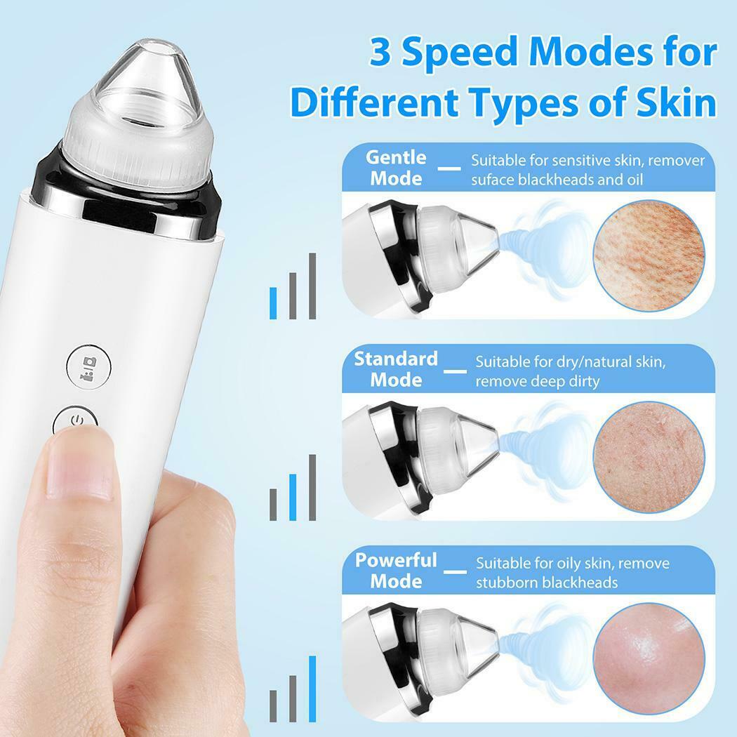 Blackhead Remover with a HD camera