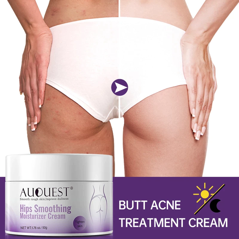 Butt Acne Treatment Cream