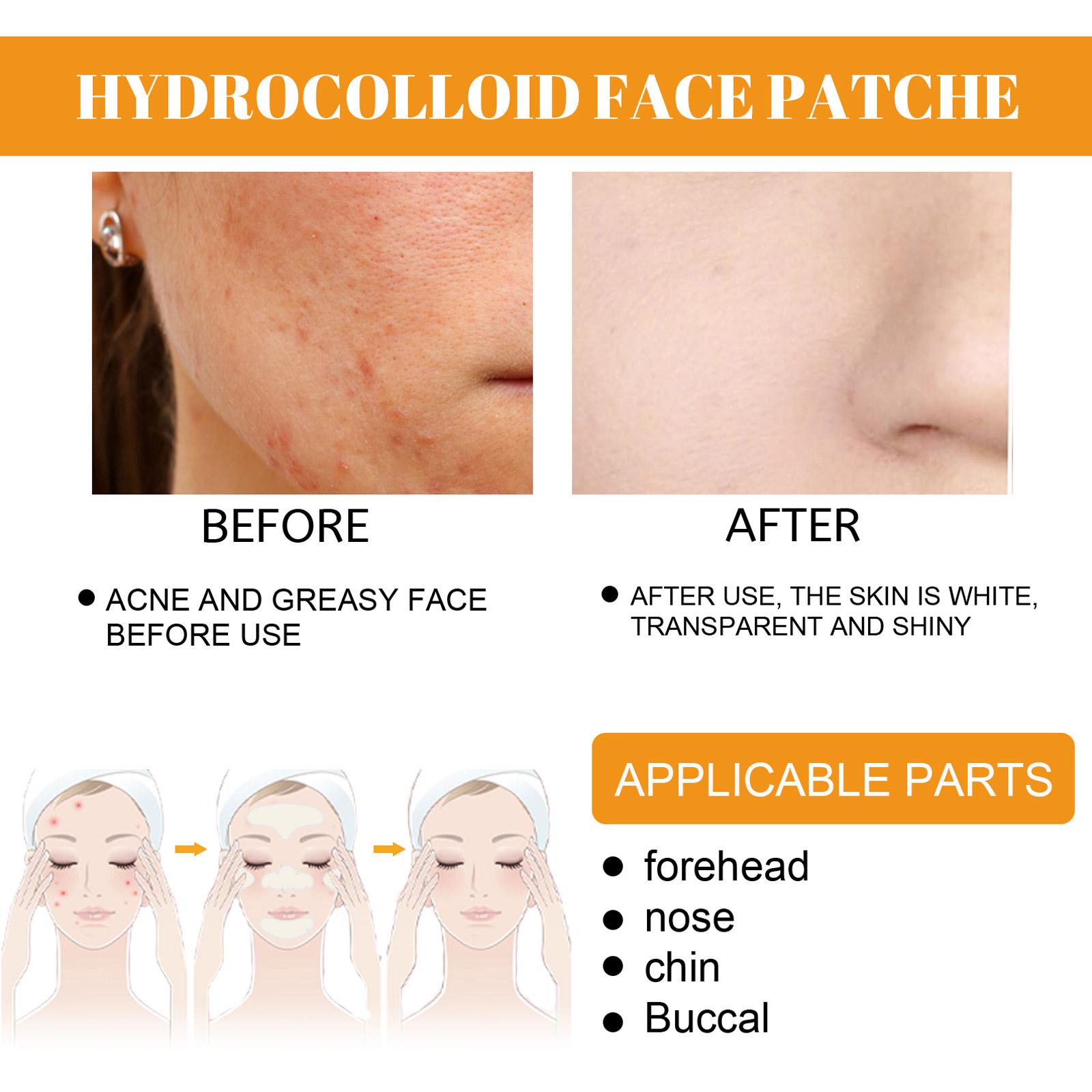 Blemish Pimple Patch