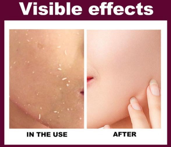 Deep Cleansing Exfoliating Peeling Gel