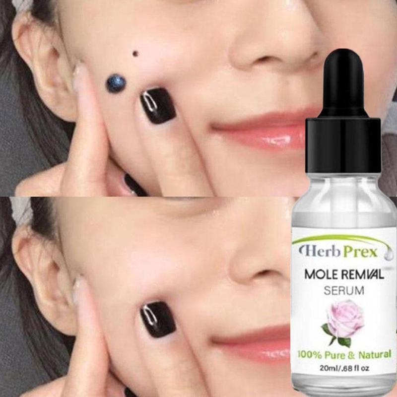 Mole Removal Serum