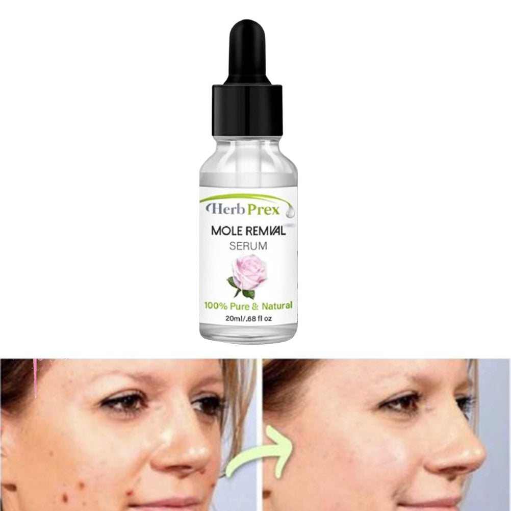 Mole Removal Serum
