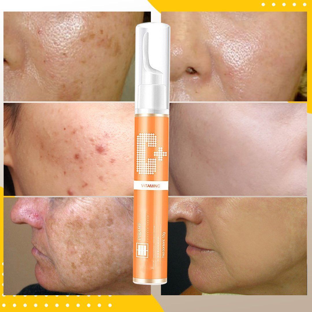 Instant Blemish Removal Gel