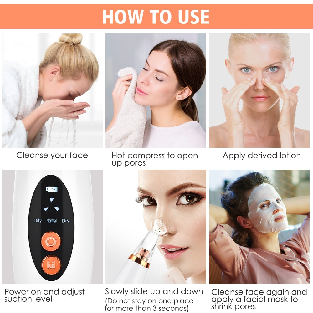 Microdermabrasion Kit