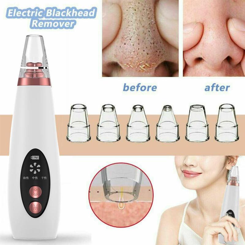 Vacuum Pore Cleaner and blackhead Remover