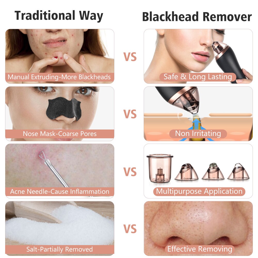 Microdermabrasion Rejuvenation Kit