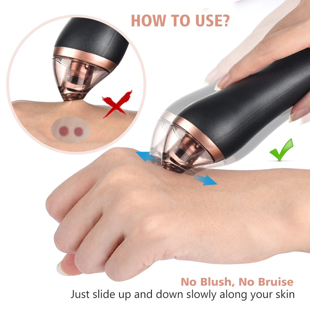 Microdermabrasion Rejuvenation Kit