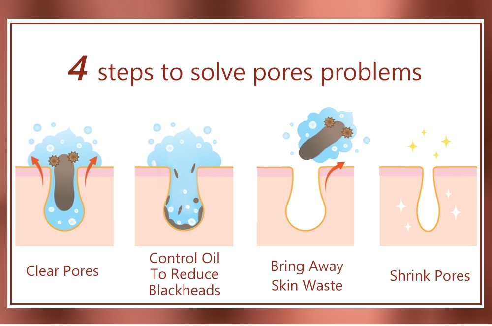 Pore Minimizer Serum (Salicylic Acid Serum)