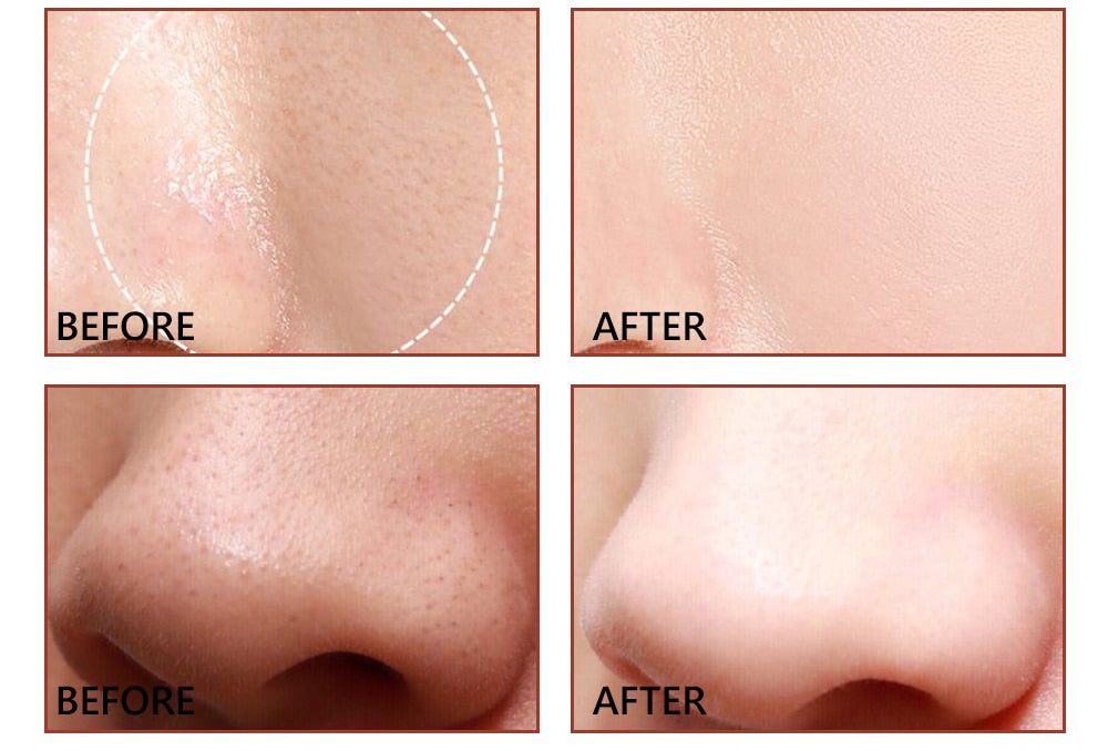 Pore Minimizer Serum (Salicylic Acid Serum)