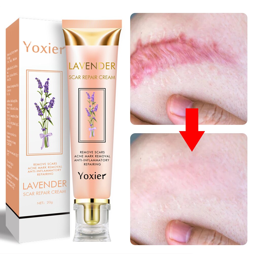 Scar Repair Removal Cream