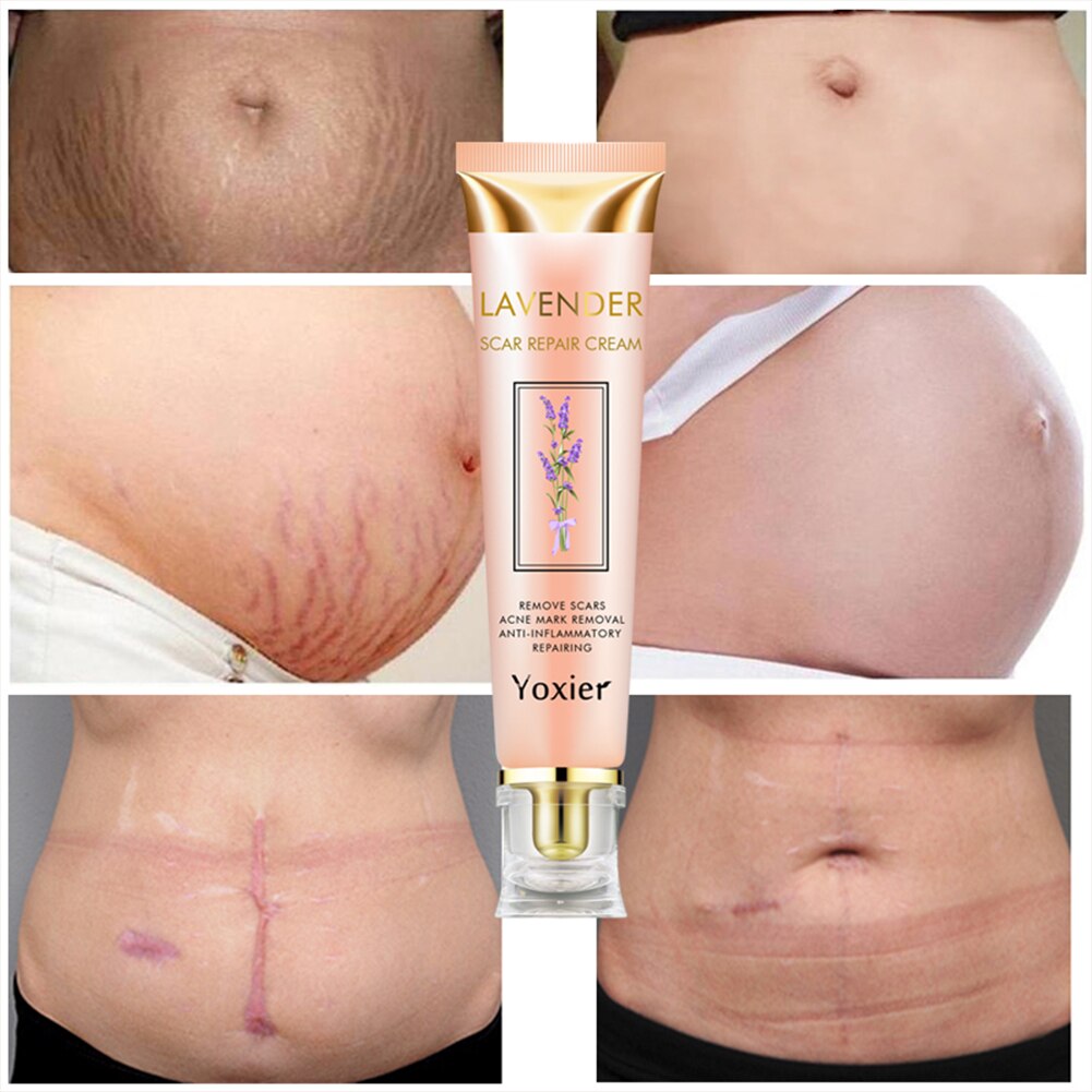 Scar Repair Removal Cream