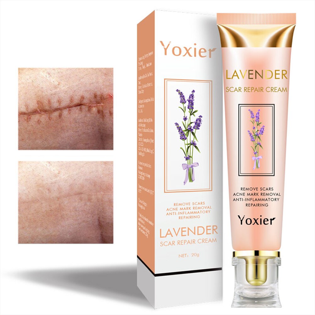 Scar Repair Removal Cream