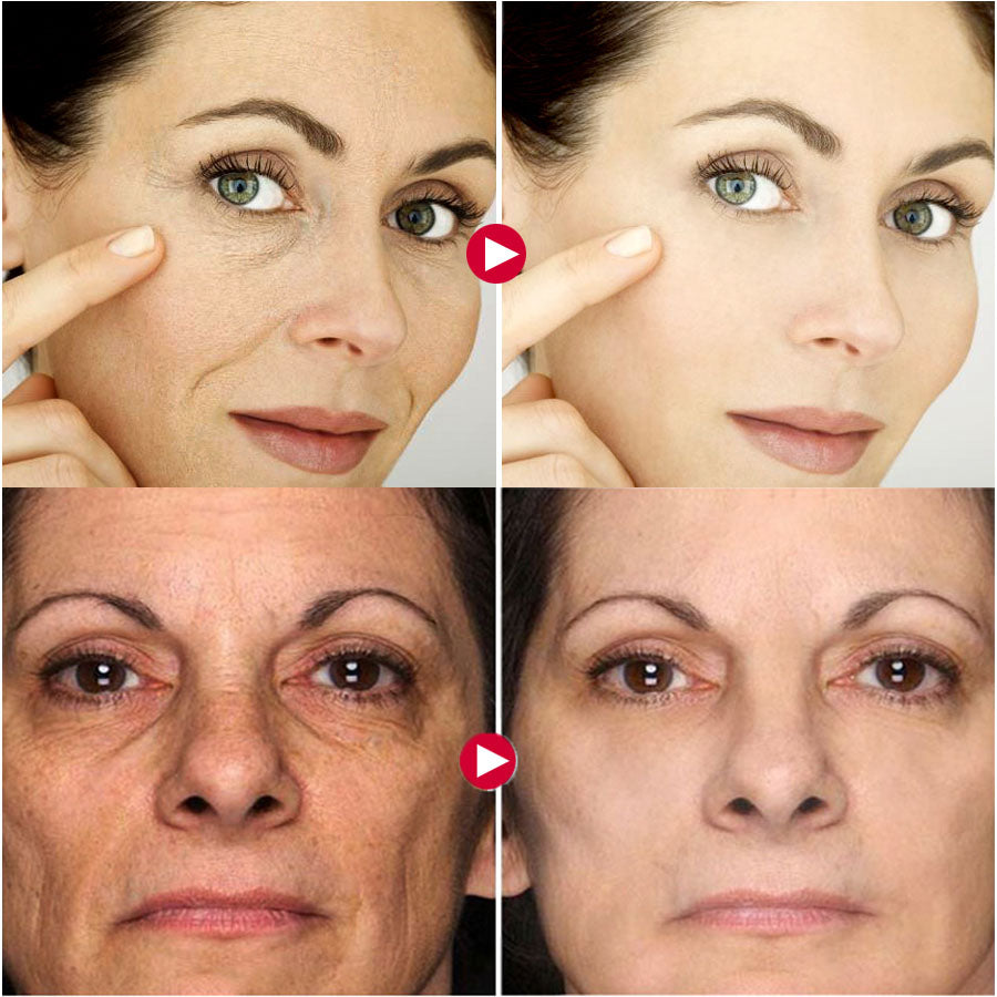 Botox Face Wrinkles Serum