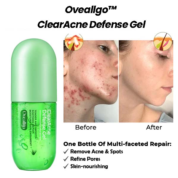 ClearAcne Ultimate Defense Gel
