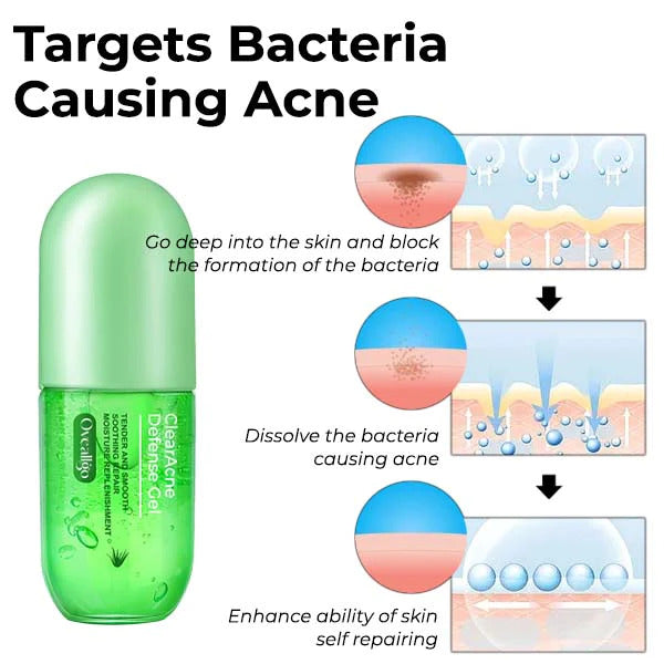 ClearAcne Ultimate Defense Gel