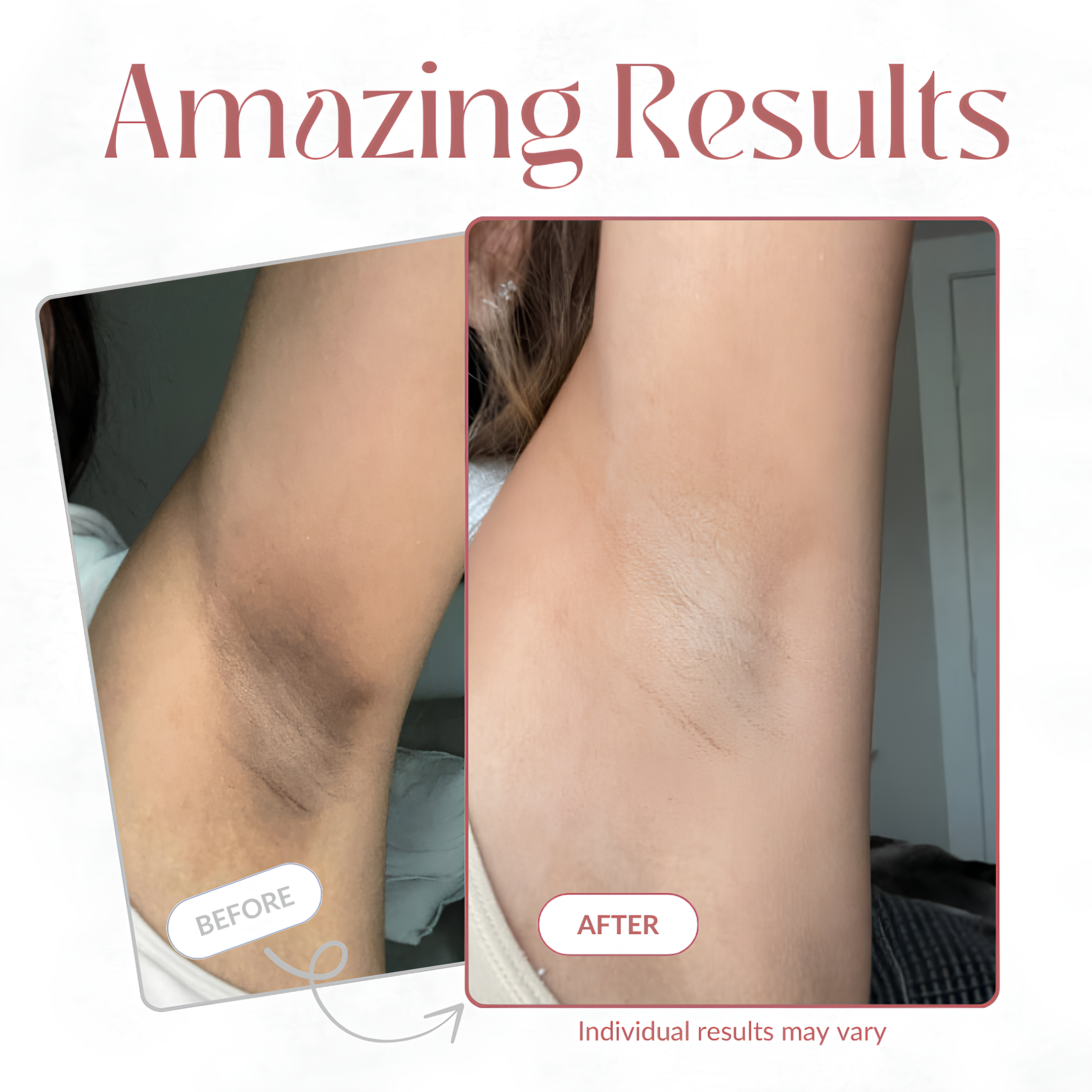 Peel Shot Kojic Spray