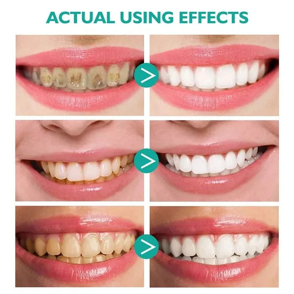 Teeth Whitening Mousse