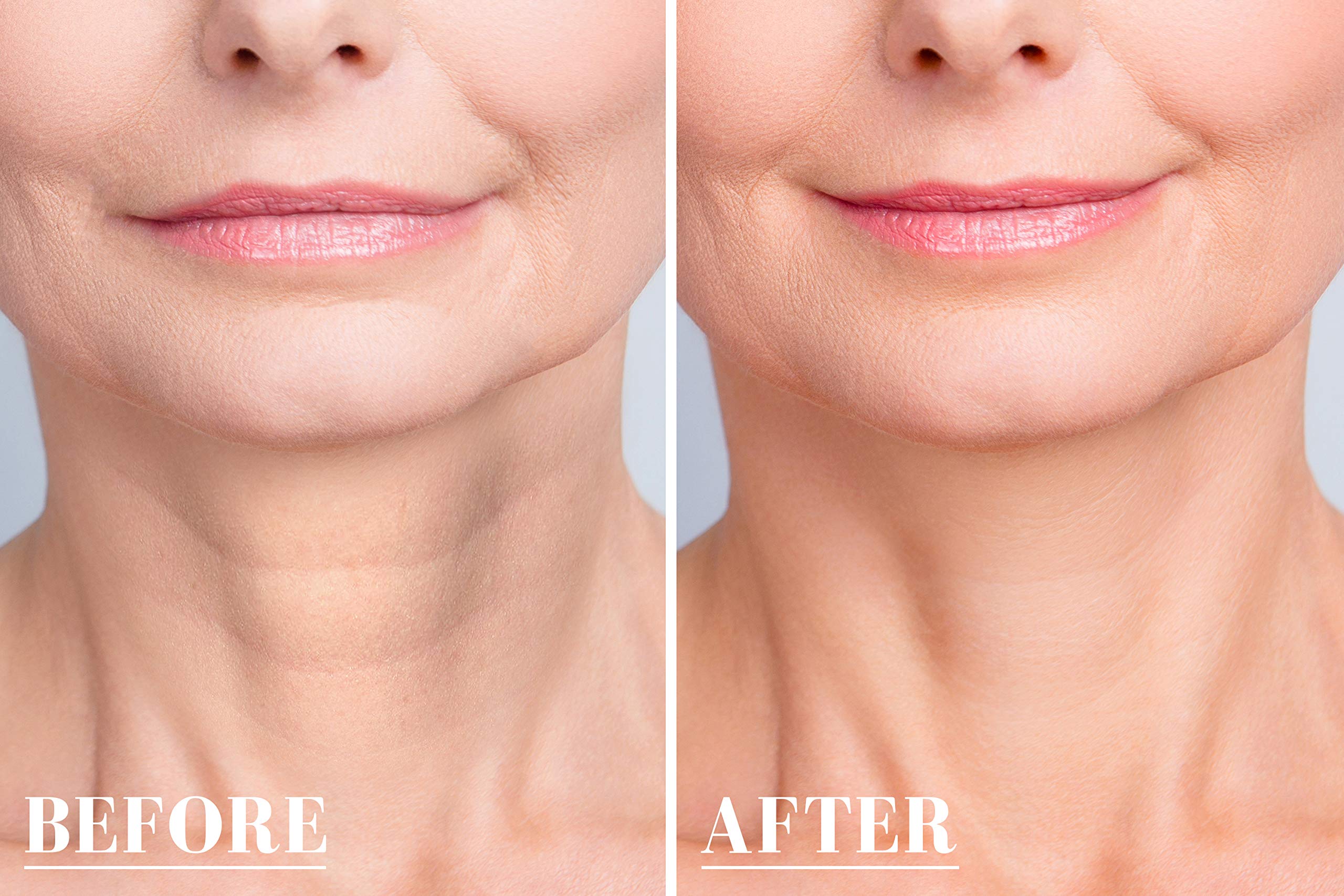 Anti-Wrinkle Mask