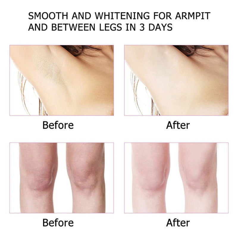 Whitening Cream For Underarm Dark Skin Legs Knees