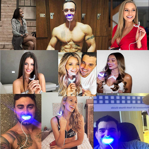 Professional Teeth Whitening Kit