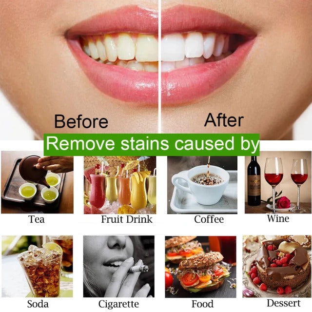 Charcoal Teeth Whitening