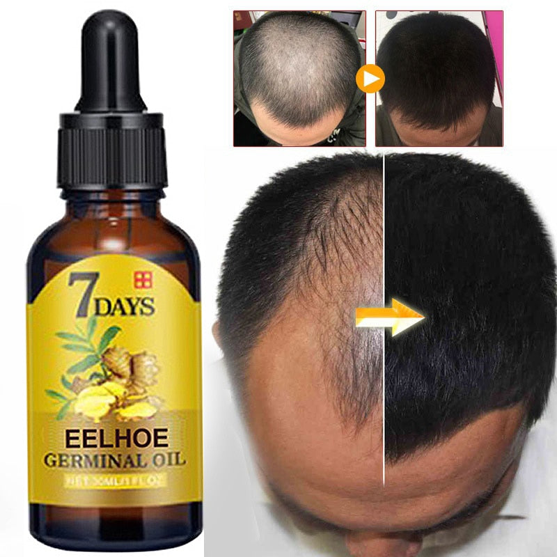 Hair Growth Serum
