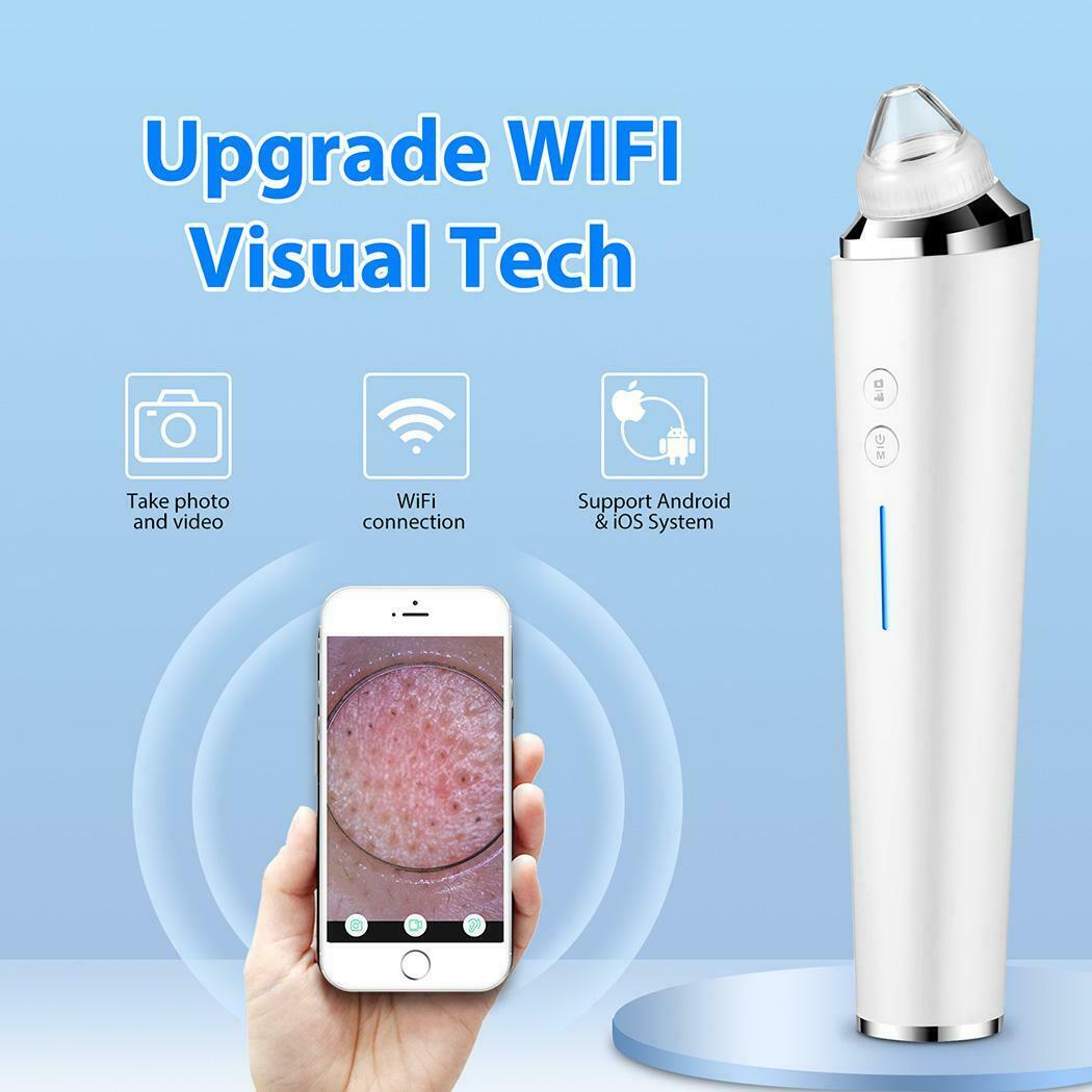 Blackhead Remover with a HD camera