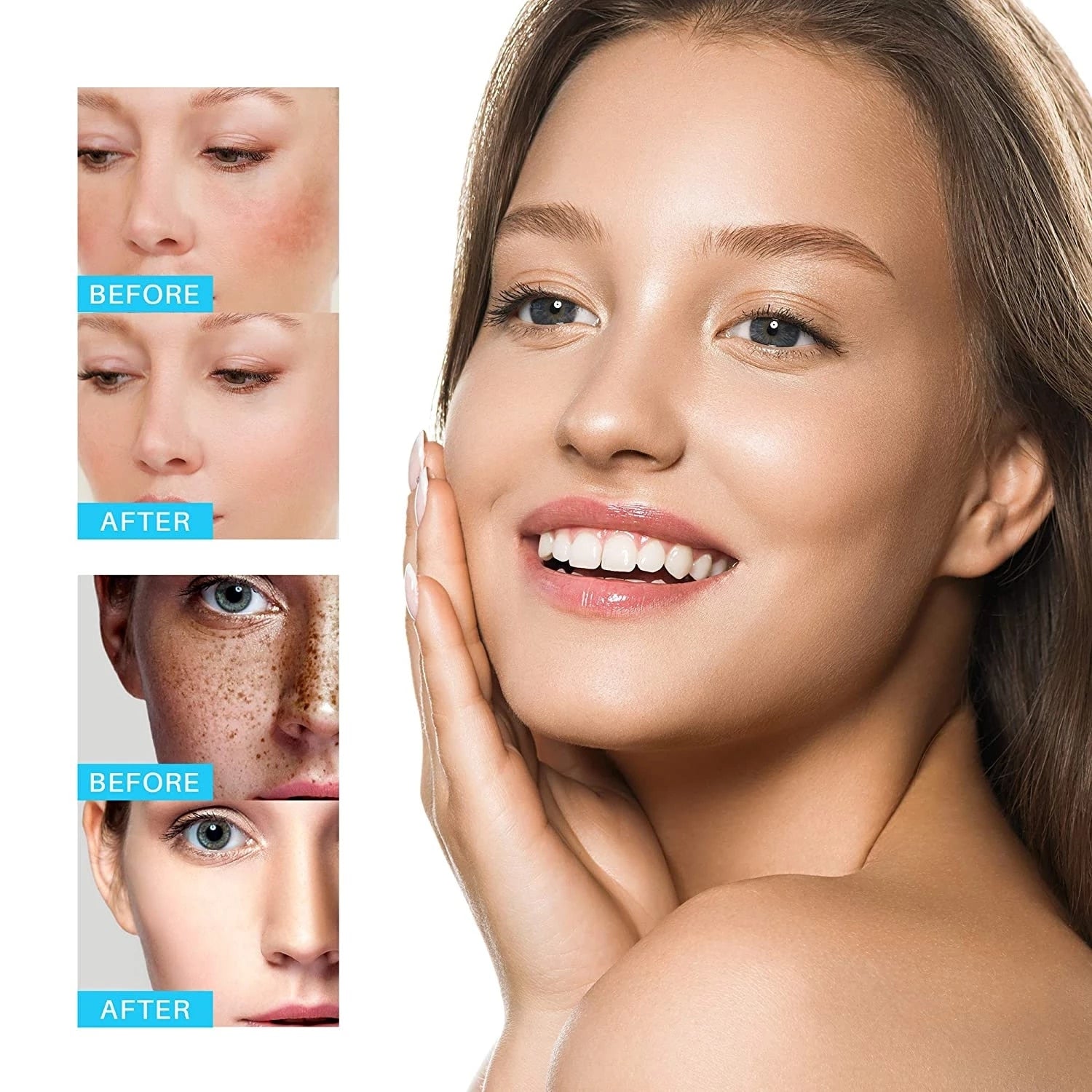 Dark Spots Remover