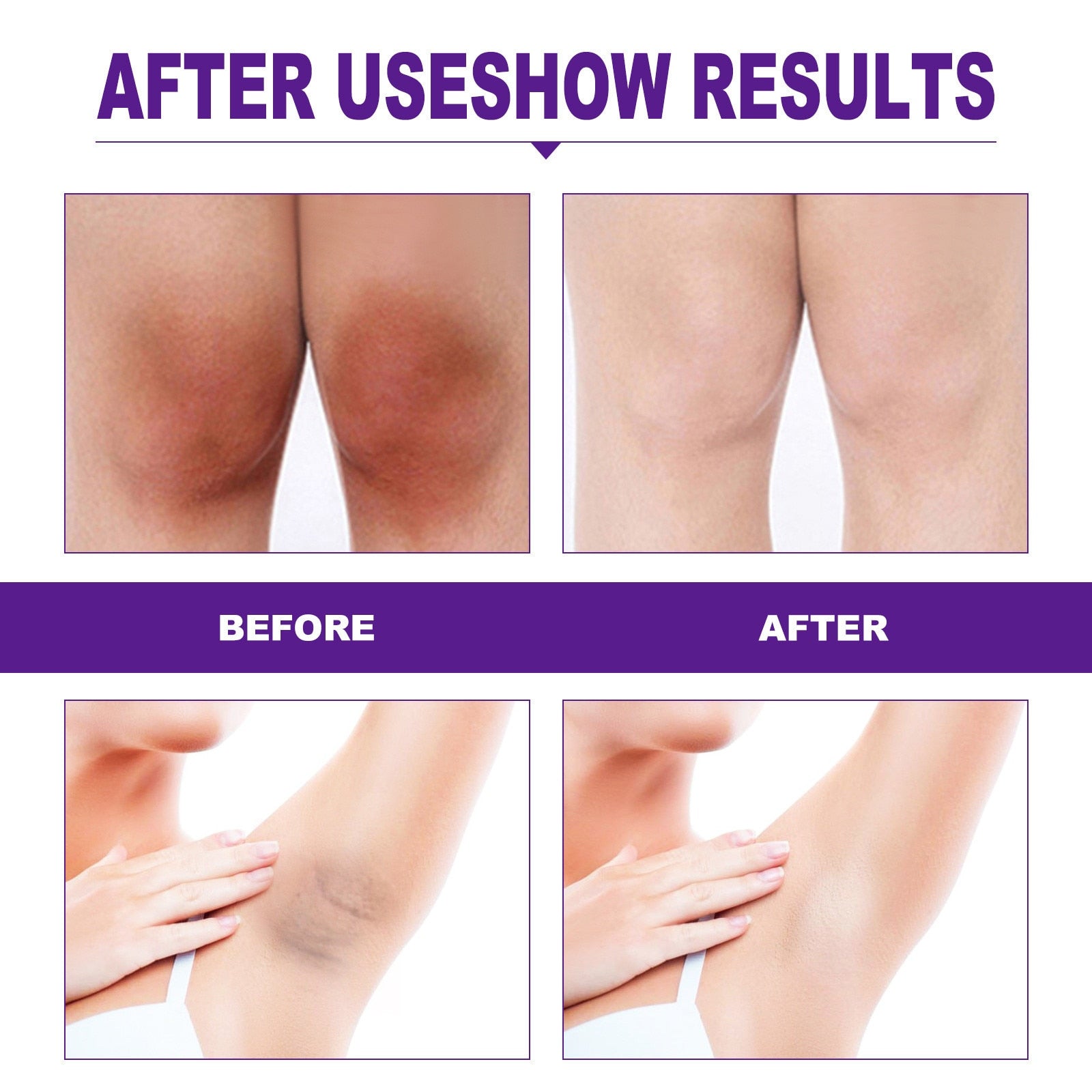 Body Whitening Cream