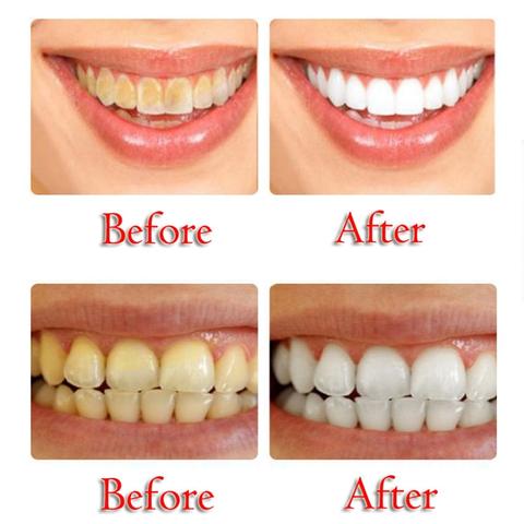 Magic Baking Soda Toothpaste