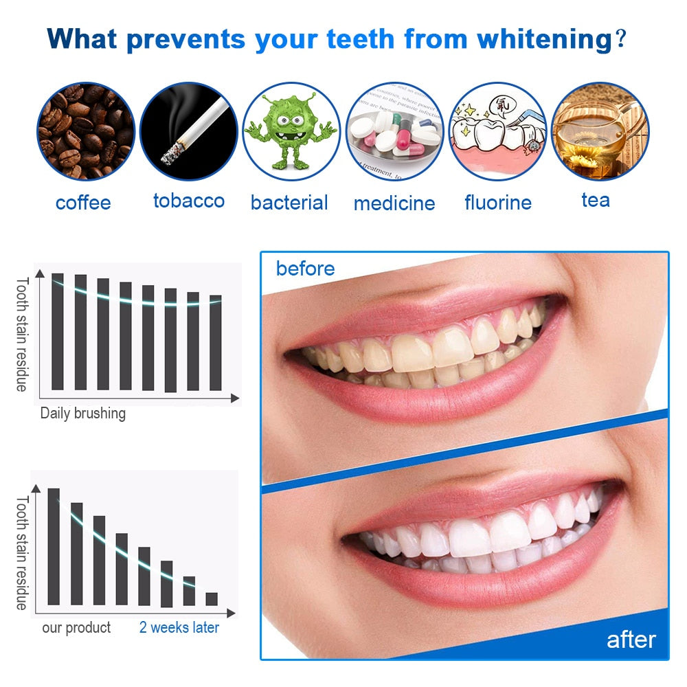 Advanced Teeth Whitening Strips