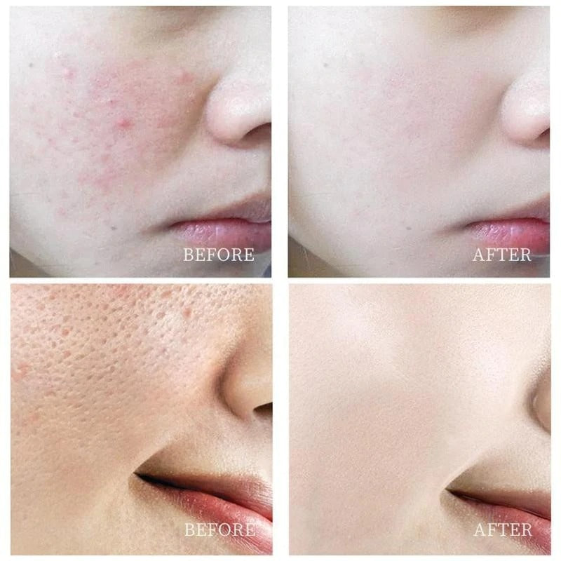 Whitening Body Cream