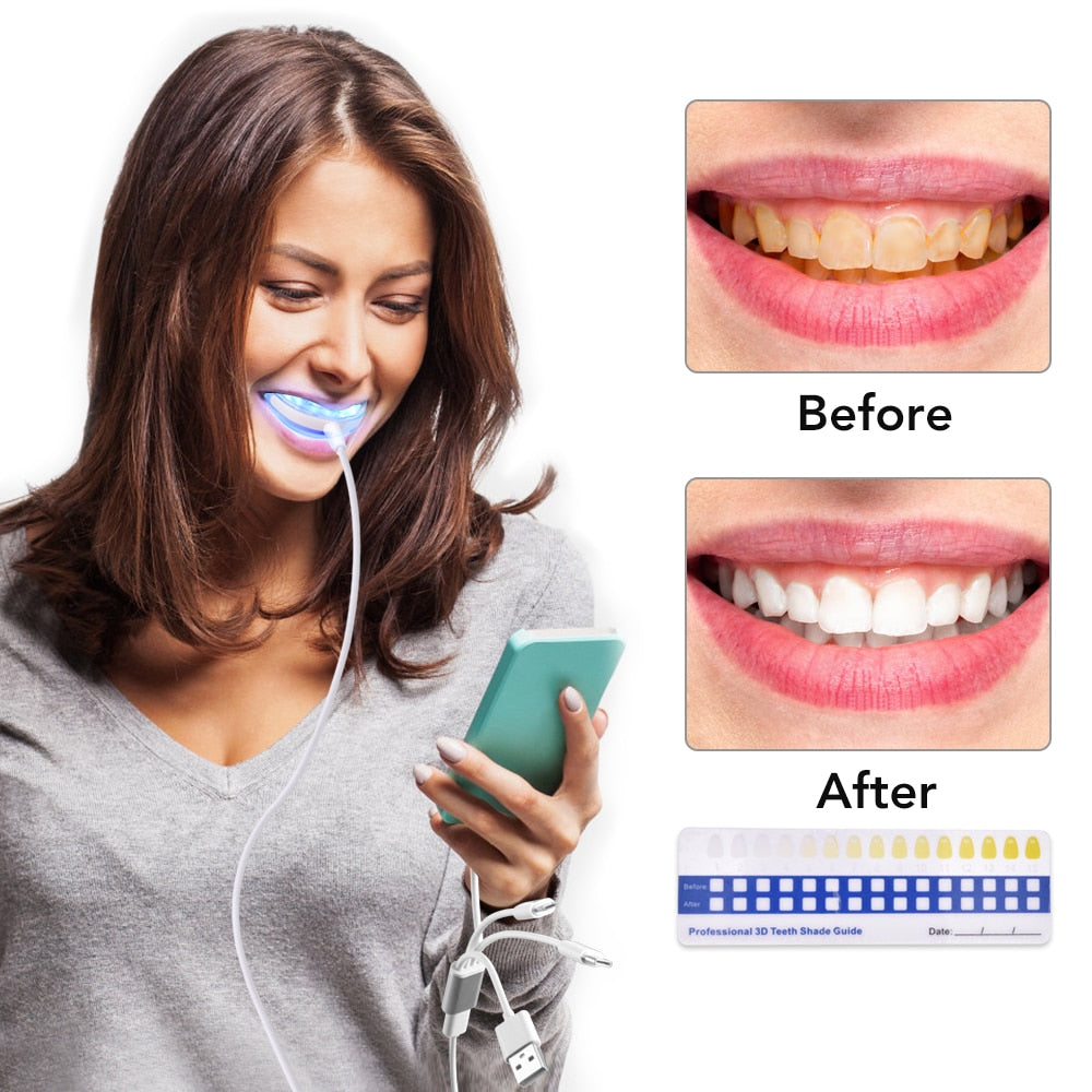 Professional Teeth Whitening Kit