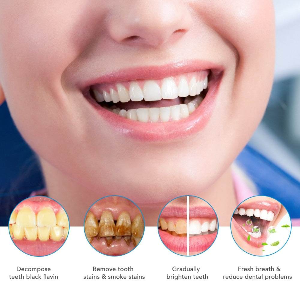 Professional Teeth Whitening Kit