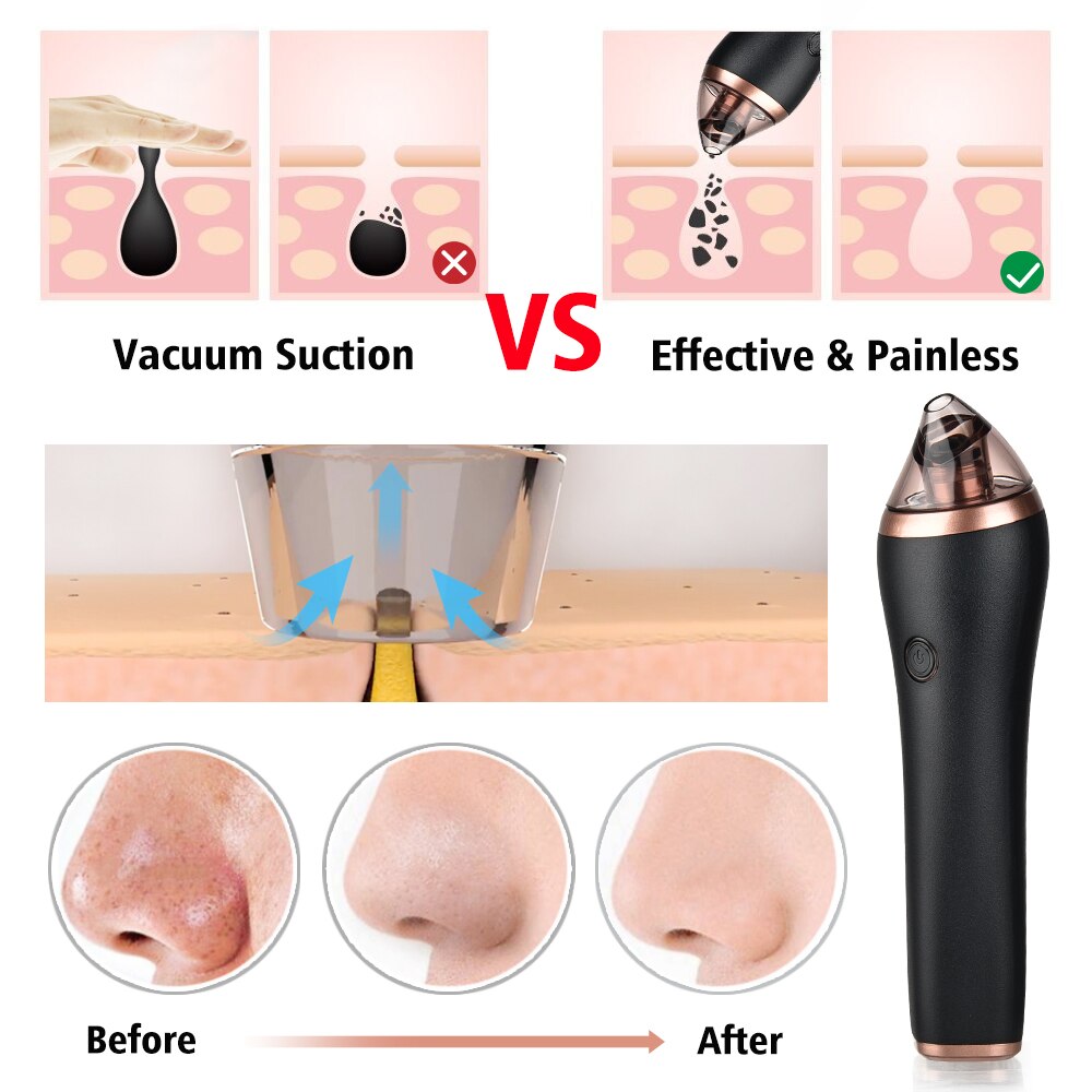 Microdermabrasion Rejuvenation Kit