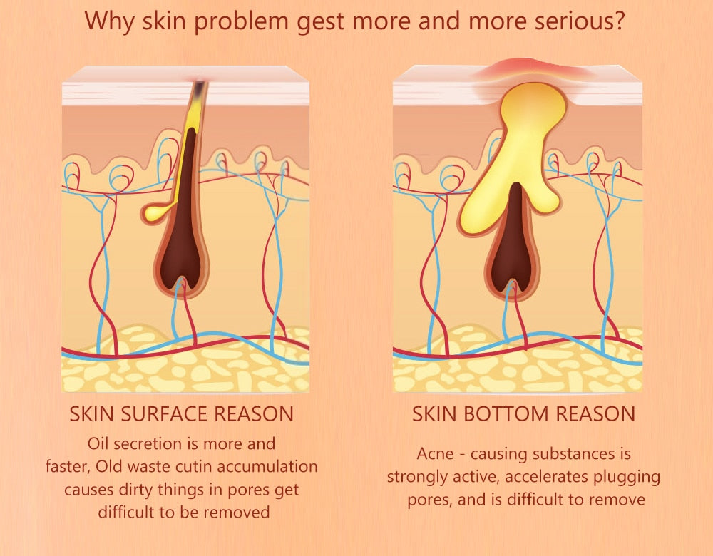 Pore Minimizer Serum (Salicylic Acid Serum)