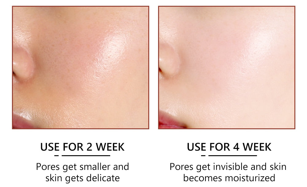 Pore Minimizer Serum (Salicylic Acid Serum)