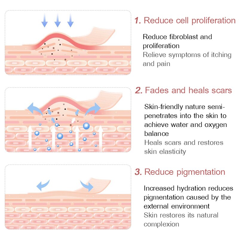 Acne Scar Removal Cream