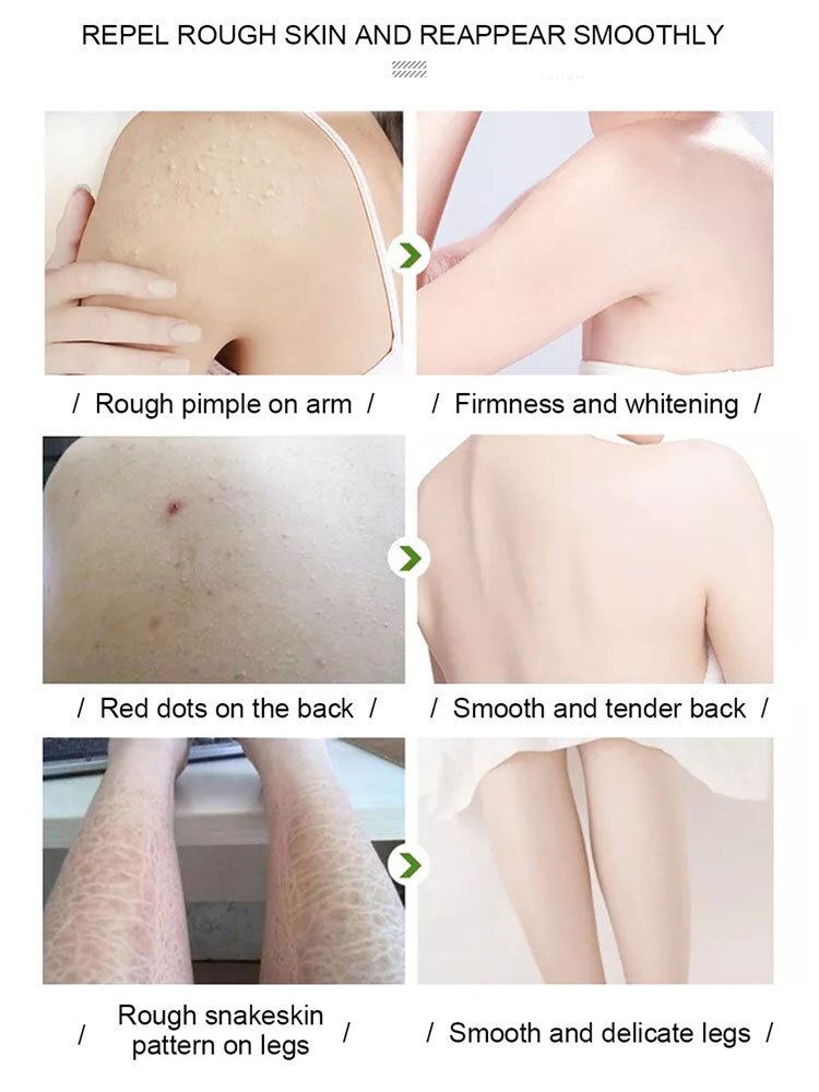 Yoxier Exfoliating Face Scrub