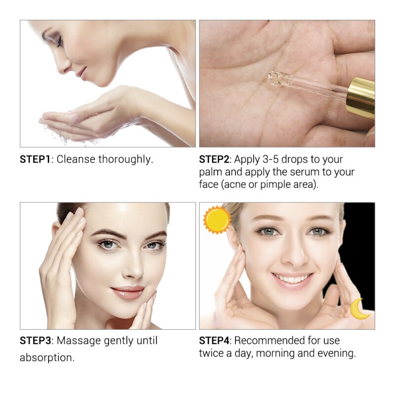 Acne Treatment Face Serum