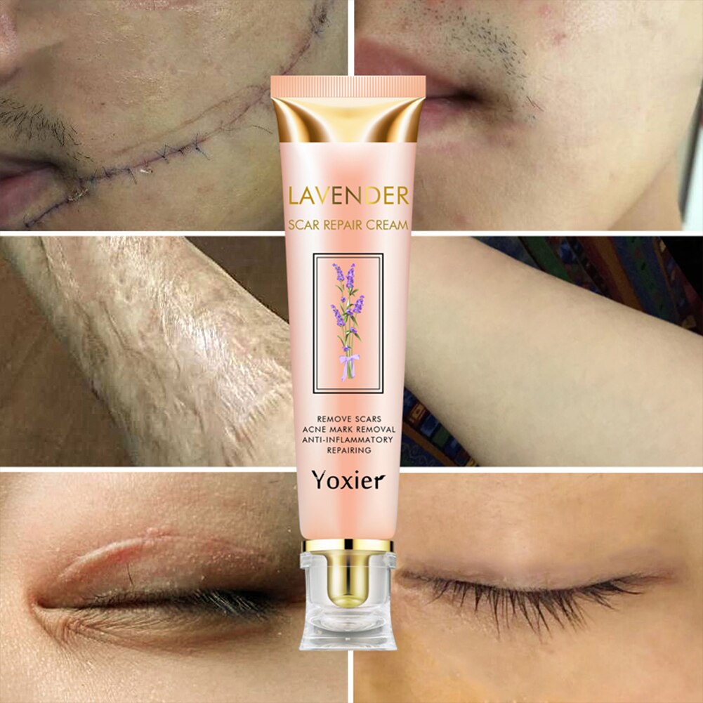 Scar Repair Removal Cream