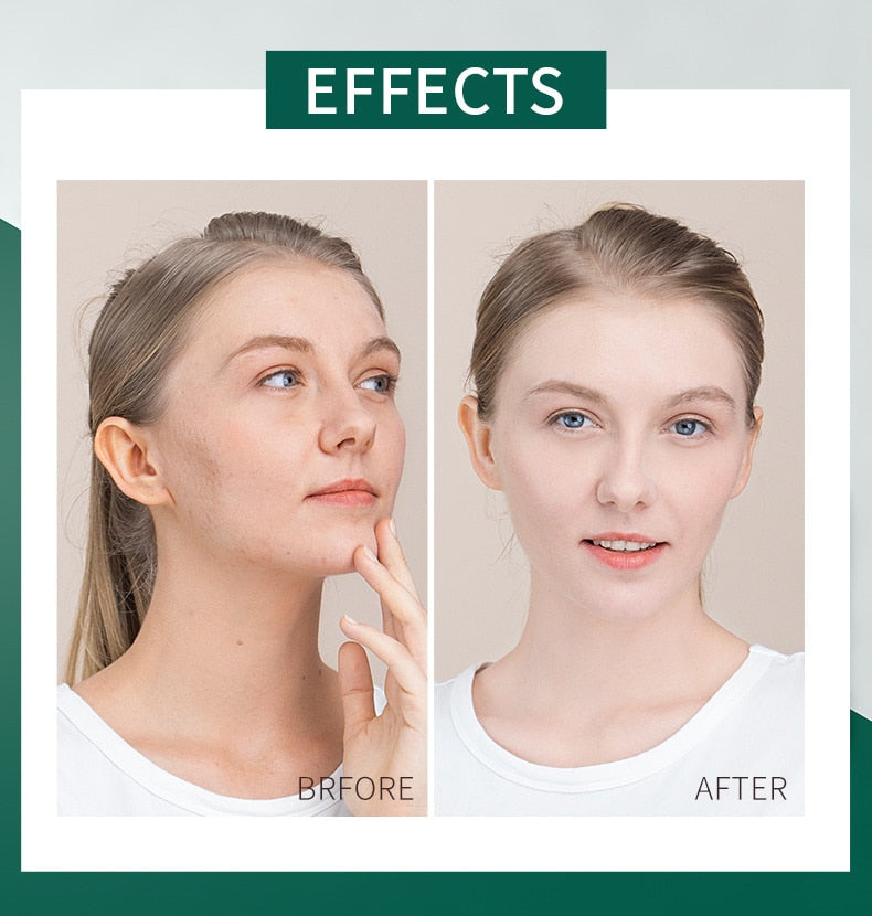 Frozen Sleeping Deep Mask