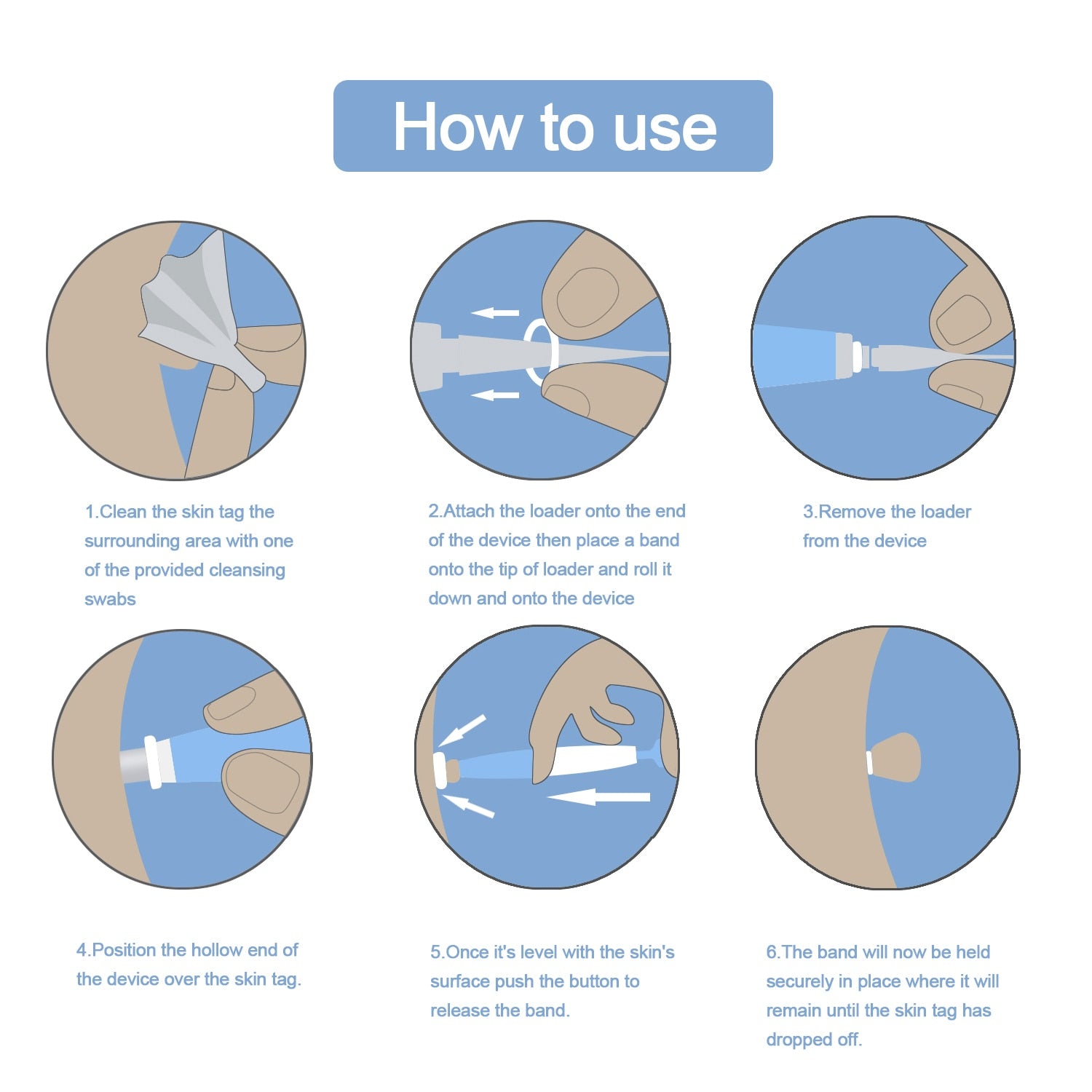 Skin Tag Removal Kit