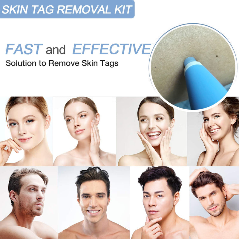 Skin Tag Removal Kit