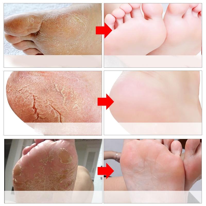 Exfoliating Foot Mask